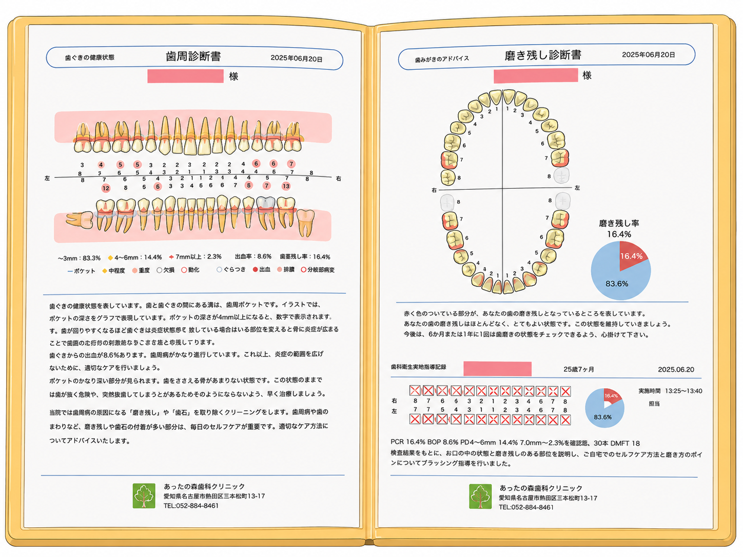 健康手帳の歯周診断書・磨き残し診断書のグラフ